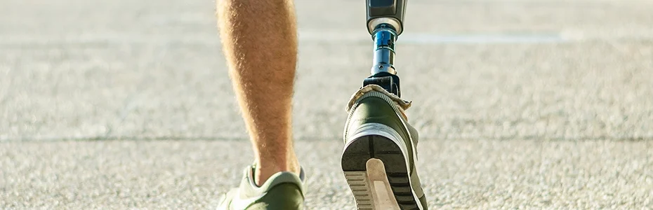 Limb Care Person Walking With Prosthetic Lower Limb After Learning How to Care for Residual Limb