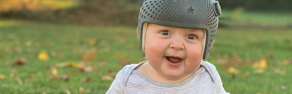 Child With a Starband Cranial Remolding Orthosis Smiling