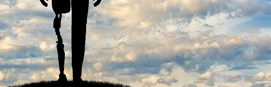 The Emotional Side of Limb Loss and Regaining Confidence