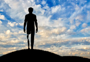 The Emotional Side of Limb Loss and Regaining Confidence