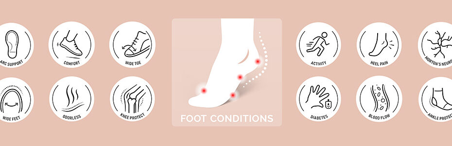 Common Foot Problems Custom Orthotics Can Help Correct