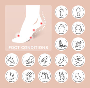 Common Foot Problems Custom Orthotics Can Help Correct