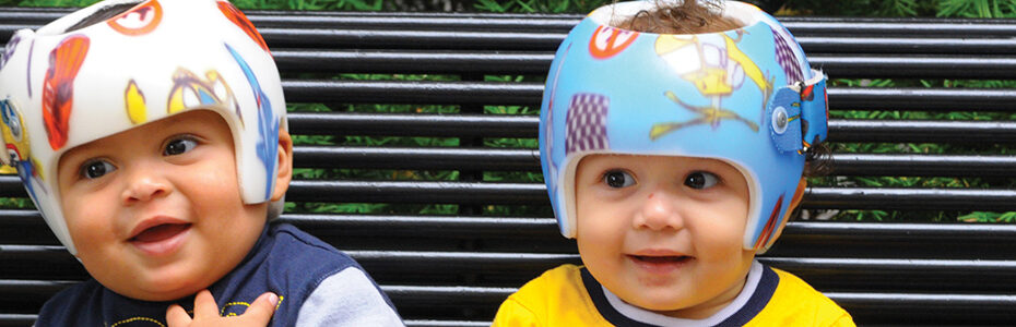 When Should a Baby Be Evaluated for a Cranial Helmet?