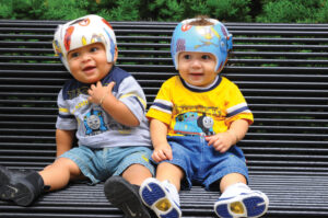 When Should a Baby Be Evaluated for a Cranial Helmet?