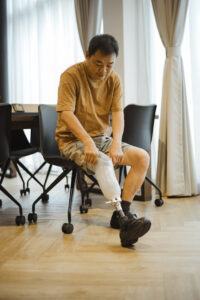 How to Know If Your Prosthetic Socket Fits Correctly