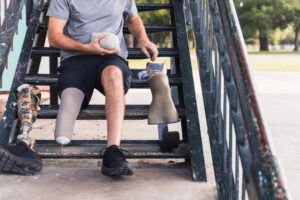 Signs You Need a New Prosthesis