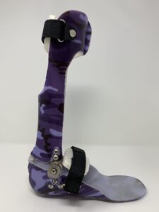 Why Custom Orthotic Bracing Is About More Than Just Holding a Joint Still